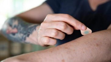 C'est vrai... Les tatouages peuvent aider à surveiller le diabète 2 Microagulhas para tatuar