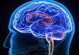 Implante cerebral