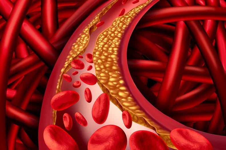 Nuovo vaccino abbatte il colesterolo alto del 30% in laboratorio: costa meno dei farmaci