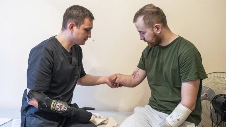 Prothèses bioniques permettent aux soldats ukrainiens blessés de retrouver leurs membres après la guerre 2 Alexis Cholas examine un soldat amputé, Volodymyr Symyshyn, à l'hôpital de Kyiv, en Ukraine. Crédit : AP Photo/Evgeniy Maloletka