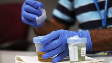 Enfin, nous savons pourquoi l'urine est jaune : la découverte des scientifiques 20 Finalmente sappiamo perché l’urina è gialla: la scoperta degli scienziati