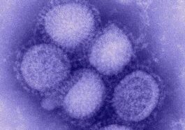 Influenza suina o influenza stagionale, come riconoscere le infezioni da H1N1 e perché sono diverse