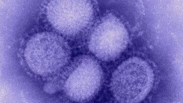Grippe porcine ou grippe saisonnière, comment reconnaître les infections par le H1N1 et pourquoi sont-elles différentes 28 Influenza suina o influenza stagionale, come riconoscere le infezioni da H1N1 e perché sono diverse