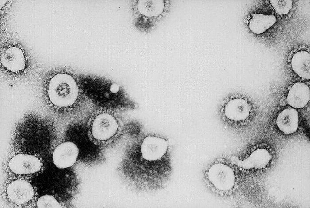 Quali sono i dieci virus respiratori che possono causare una nuova pandemia
