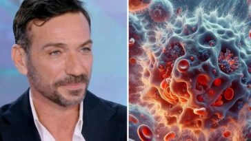 Qu'est-ce que la rare maladie auto-immune : symptômes et traitements 8 Cos’è la rara malattia autoimmune di cui soffre Costantino Vitagliano: sintomi e cure