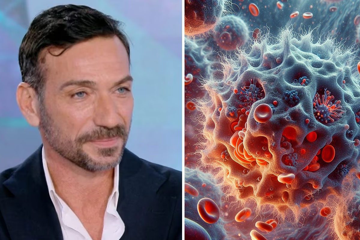 Cos’è la rara malattia autoimmune di cui soffre Costantino Vitagliano: sintomi e cure