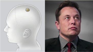 Implantation de la première puce Neuralink dans le cerveau d'un homme, Musk: "Détection de pics neuronaux" 5 Immagine