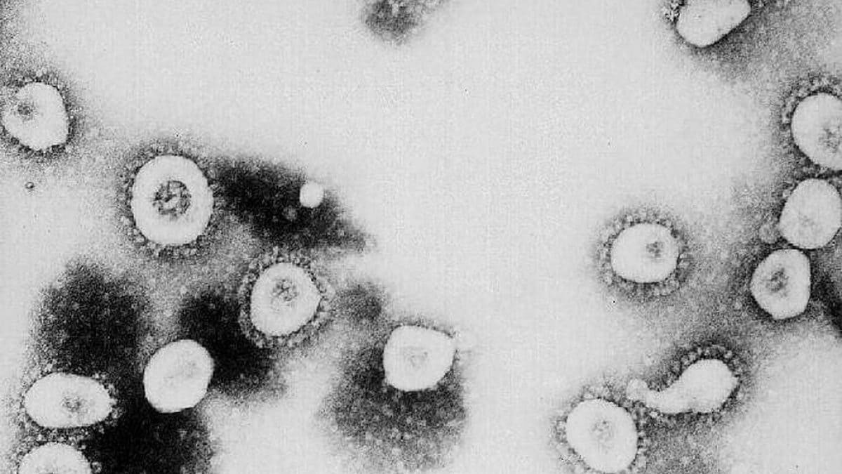 Quels sont les dix virus respiratoires qui peuvent causer une nouvelle pandémie 2 Image
