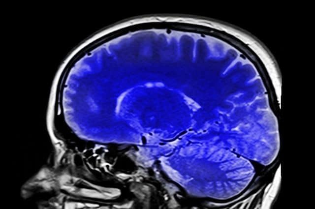 Une procédure médicale peut transmettre la maladie d'Alzheimer, selon une nouvelle étude 1 Una procedura medica può trasmettere il morbo di Alzheimer, secondo un nuovo studio