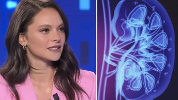 Comment vit-on avec un seul rein et pourquoi le cas de Francesca Michielin n'est-il pas rare 22 Come si vive con un rene solo e perché il caso di Francesca Michielin non è raro