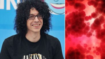 Giovanni Allevi et la maladie, qu'est-ce que le myélome multiple, quels sont les symptômes et comment traiter le cancer 29 Giovanni Allevi e la malattia, cos’è il mieloma multiplo, quali sono i sintomi e come si cura il tumore