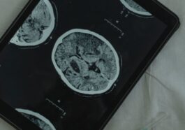 Cerveau
