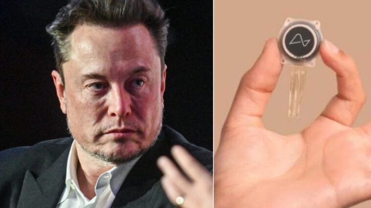 Neuralink a implanté une puce cérébrale au deuxième patient : comment s'est déroulée l'opération 1 Image