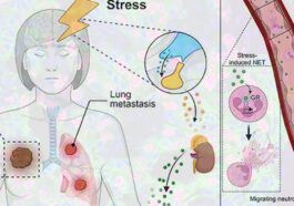 Le stress favorise la propagation du cancer et semble prédisposer les tissus au développement des tumeurs / Crédit : Xue-Yan He et al. Cancer Cell 2024