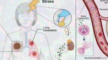 Pourquoi le stress "aide" le cancer: comment favorise-t-il la propagation des tumeurs, vu pour la première fois 22 Le stress favorise la propagation du cancer et semble prédisposer les tissus au développement des tumeurs / Crédit : Xue-Yan He et al. Cancer Cell 2024