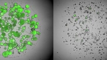 Un nouveau médicament oral élimine uniquement les cellules tumorales sans effets toxiques dans le cancer du sein agressif 22 Le cellule del cancro al seno prima e dopo il trattamento. Credit: Università di Adelaide