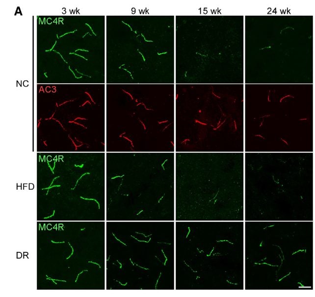 Les cils MC4R+ de souris âgées de 3 à 24 semaines, nourries avec une alimentation normale (NC), un régime riche en graisses (HFD) ou des restrictions alimentaires (DR) / Crédit : Manami Oya et al., Cell Metabolism 2024.