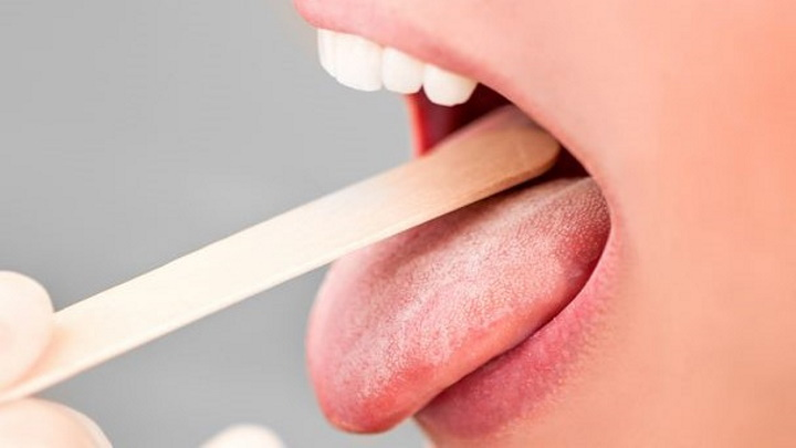 Les sucettes saveur pourraient aider à détecter le cancer de la bouche 3 1711372780 340 Les sucettes saveur pourraient aider a detecter le cancer de