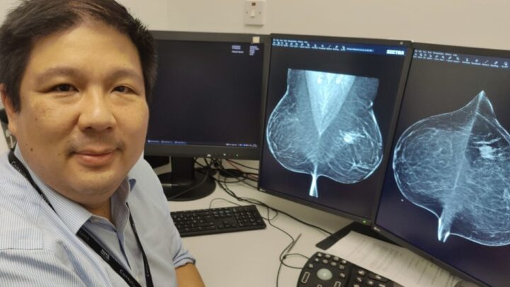 L'intelligence artificielle a détecté un cancer que les médecins n'ont pas détecté chez 11 femmes 4 1711486190 213 Lintelligence artificielle a detecte un cancer que les medecins nont