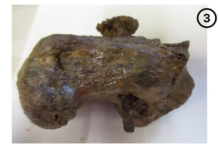 Possible cas de crucifixion découvert en Angleterre: comment on mourait par le supplice 4 Le clou avec la pointe cassée dans le talon. Crédit : Galassi et al
