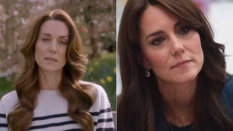 À quel stade a été trouvé le cancer de Kate Middleton : l'analyse du médecin 1 Image