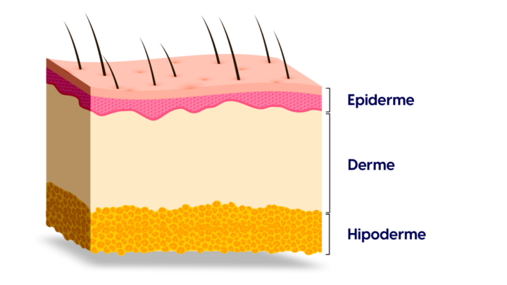 Avec succès, les chercheurs ont utilisé l'impression 3D de peau lors d'une opération 4 Avec succes les chercheurs ont utilise limpression 3D de peau