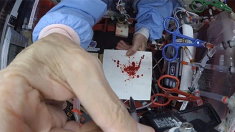 CSI dans l'espace, naissance de la science astroforensique pour résoudre les homicides en microgravité : le test 1 Il test sulle macchie di sangue condotto in microgravità. Credit: Zack Kowalske / Staffordshire University / SWNS