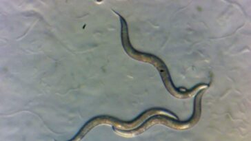Certains vers de Tchernobyl sont exceptionnellement résistants aux radiations 23 Vermi raccolti nella zona di esclusione di Chernobyl, visti al microscopio. Credit: Sophia Tintori/Università di New York