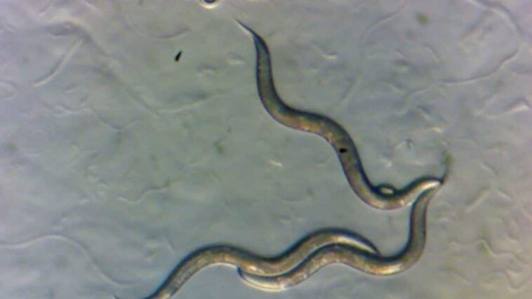 Certains vers de Tchernobyl sont exceptionnellement résistants aux radiations 1 Vermi raccolti nella zona di esclusione di Chernobyl, visti al microscopio. Credit: Sophia Tintori/Università di New York
