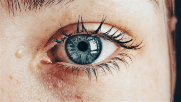 Imprimer de la peau vivante sur des blessures : la solution technologique pour dire adieu aux cicatrices
