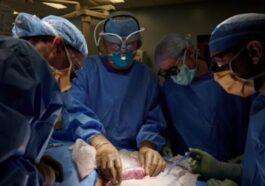 Inédito: rim de porco transplantado num paciente vivo
