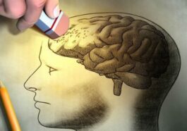 Image de la maladie d'Alzheimer, qui peut être transmise par le sang d'un donneur