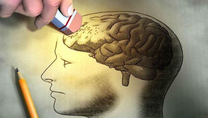 Les transfusions sanguines peuvent-elles propager la maladie d'Alzheimer ? 2 Image de la maladie d'Alzheimer, qui peut être transmise par le sang d'un donneur