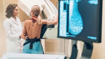 Illustration de MIA, l'IA pour la détection du cancer du sein