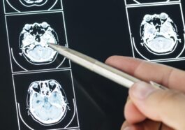 Presque une personne sur deux dans le monde a une maladie neurologique : l'étude de l'OMS 25 Image