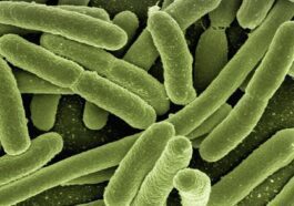 Qu'est-ce que l'Escherichia coli : symptômes, complications et traitement de l'infection causée par la bactérie 31 Micrografia elettronica a scansione di Escherichia coli. Credit: Rocky Mountain Laboratories / NIAID / Pixabay