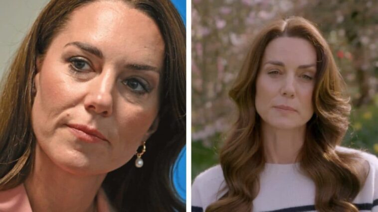 Qu'est-ce que la chimiothérapie préventive que fait Kate Middleton et quels en sont les effets 1 Imagem