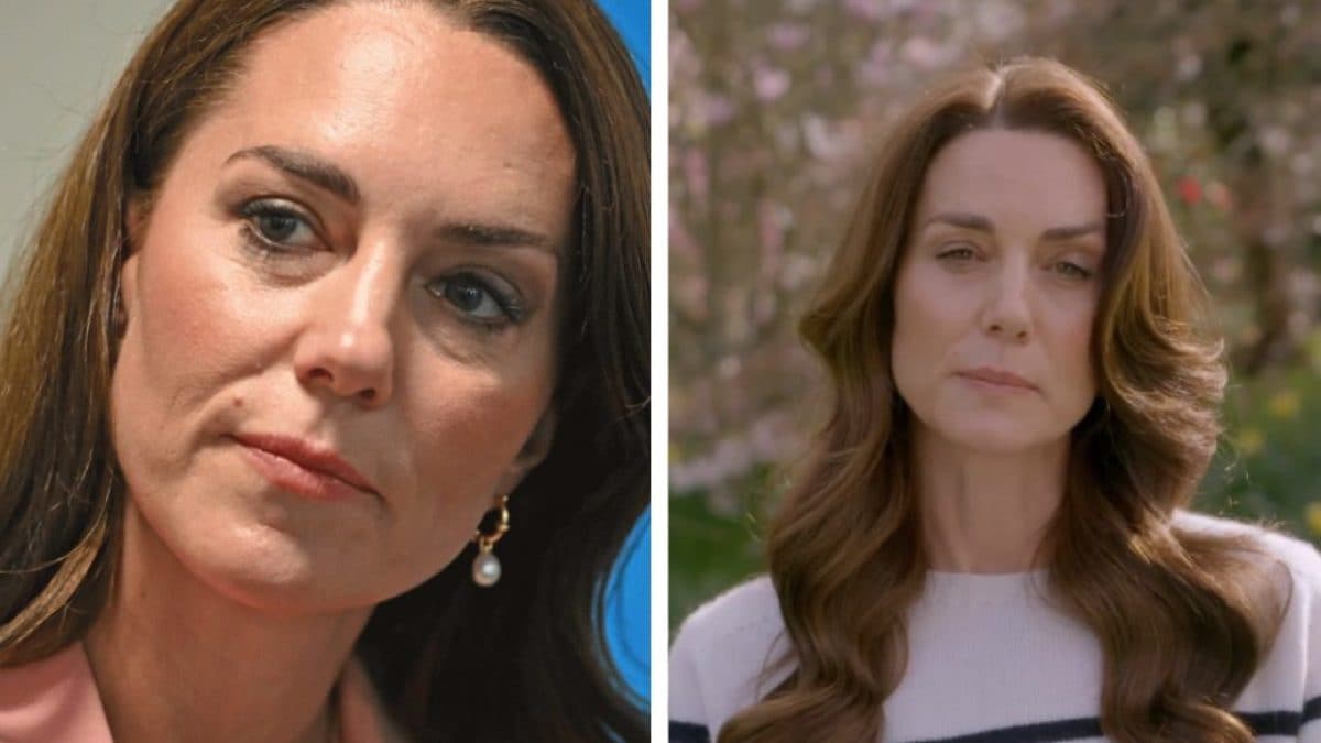 Qu'est-ce que la chimiothérapie préventive que fait Kate Middleton et quels en sont les effets 2 Imagem