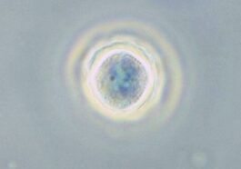 Une amibe du genre Acanthamoeba, un type de protistes