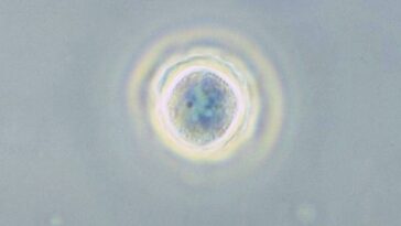 Qu'est-ce que l'amibe dévoreuse de cerveau, symptômes et pourquoi les lavages nasaux augmentent le risque de l'attraper 9 Une amibe du genre Acanthamoeba, un type de protistes