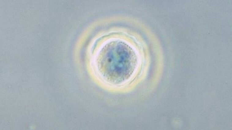 Qu'est-ce que l'amibe dévoreuse de cerveau, symptômes et pourquoi les lavages nasaux augmentent le risque de l'attraper 1 Une amibe du genre Acanthamoeba, un type de protistes