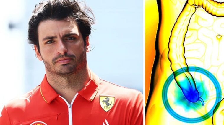 Qu'est-ce que l'appendicite, symptômes et traitement de l'inflammation qui a contraint Carlos Sainz à subir une intervention 1 Le pilote de Ferrari Carlos Sainz, contraint de subir une appendicite à Djeddah (Arabie saoudite)