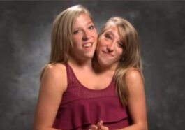 Credit: Abigail “Abby” Loraine Hensel e Brittany “Britty” Lee Hensel/ TikTok