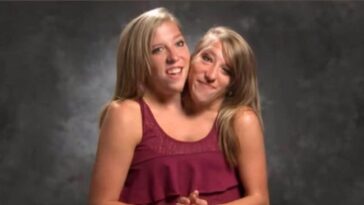 Qu'est-ce que les jumeaux siamois céphalopages (avec deux têtes): le cas d'Abby et Britty 6 Credit: Abigail “Abby” Loraine Hensel e Brittany “Britty” Lee Hensel/ TikTok