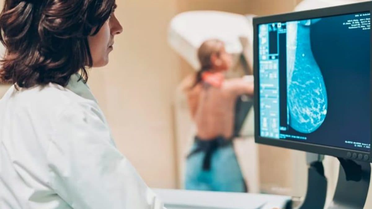 Une nouvelle intelligence artificielle peut prévenir le cancer du sein avec cinq ans d'avance 2 Image
