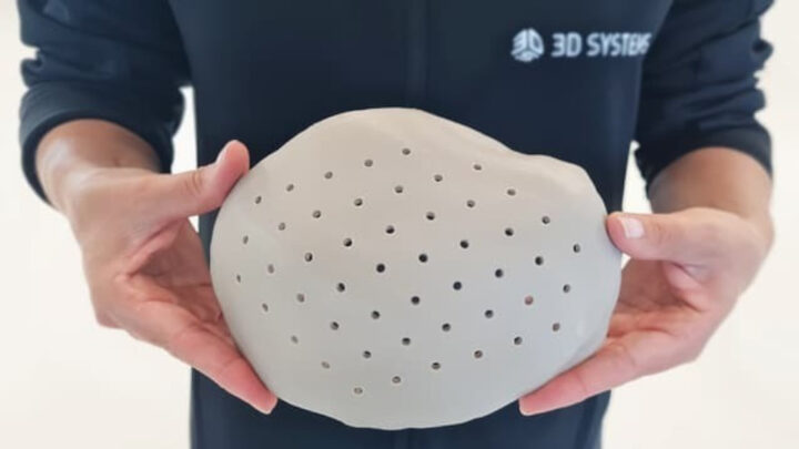 La FDA approuve les implants crâniens imprimés en 3D pour entrer sur le marché américain 3 Source: 3D Systems; "3D Systems Announces FDA Clearance for World’s First 3D-Printed PEEK Cranial Implants" (avril, 2024)