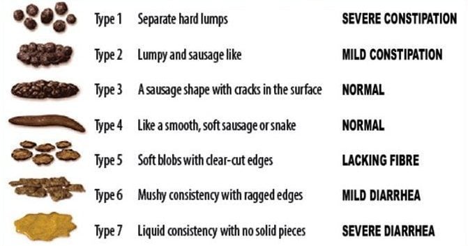 Que disent les selles de notre santé et quand faut-il s'en inquiéter 3 La Scala delle feci di Bristol (Bristol stool scale) classifica le feci per forma e consistenza in sette categorie / Credit: Cabot Health, Bristol Stool Chart