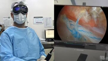 Apple Vision Pro a aidé un médecin lors d'une opération à l'épaule au Brésil 21 Illustration Apple Vision Pro utilisée au Brésil