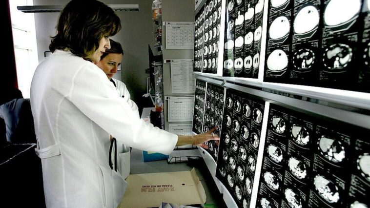 Ce que dit l'étude qui lie le vieillissement accéléré à l'augmentation des cancers chez les jeunes 1 Immagine