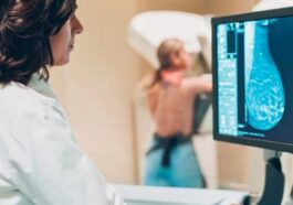 La dépression augmente le risque de passage chez les femmes atteintes de cancer du sein : que dit l'étude 45 Immagine
